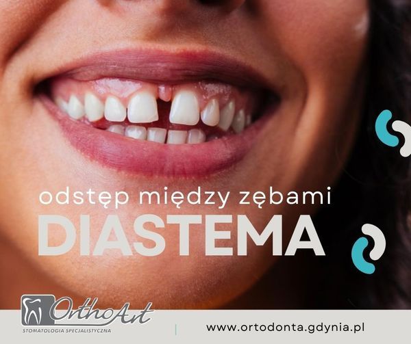 ortodonta Gdynia